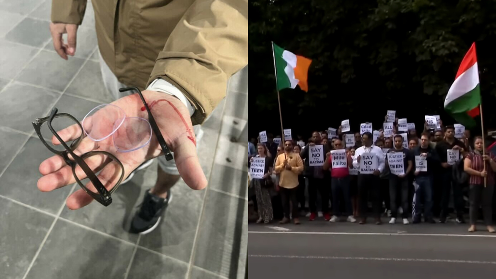 Los indios en Irlanda enfrentan una ola de violencia racista desgarradora